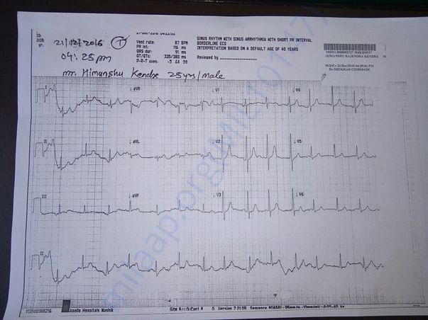 ECG-report