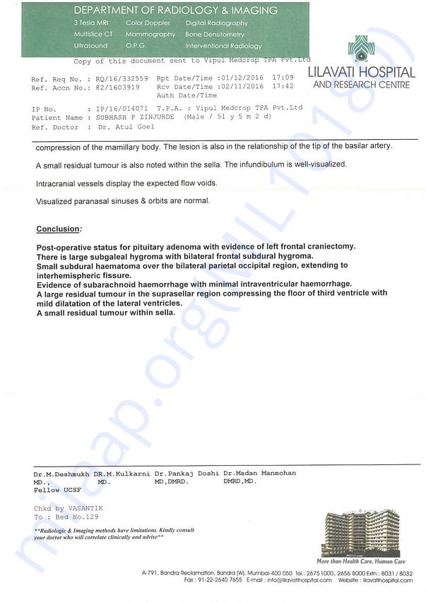 MRI-BRAIN-2