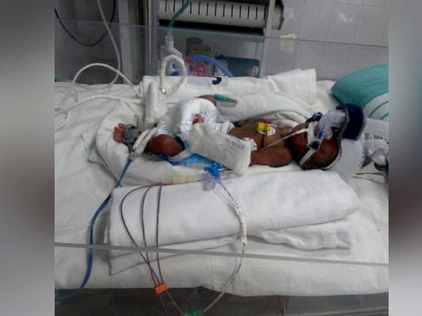 Help This Father Save His 20-Week-Old Daughter