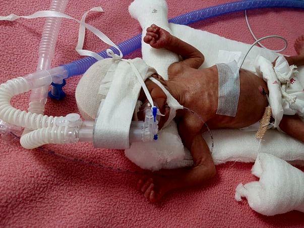 Help a new born fight a battle of life.