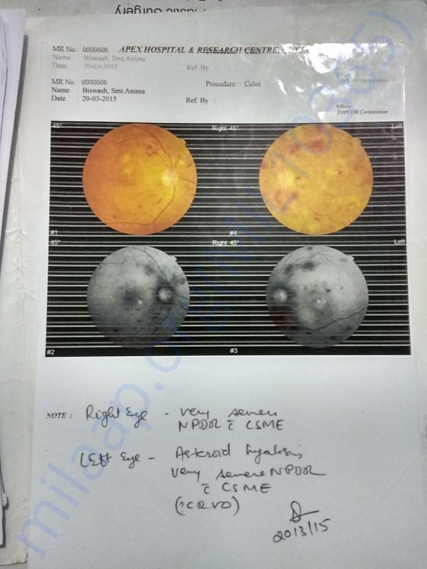 Retina scan report came very bad