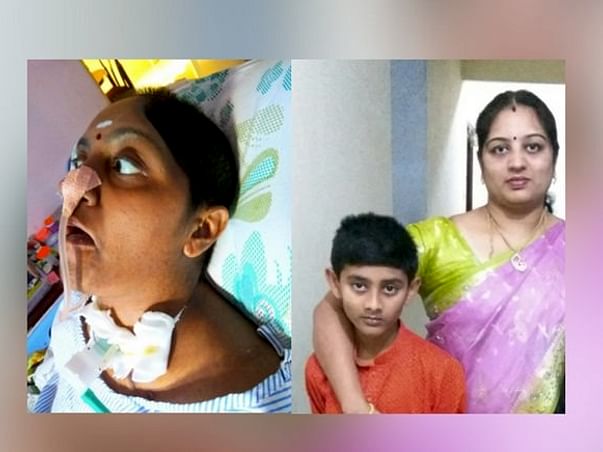 Save Suba, Mother Of My 8-Year-Old Son to Recover From Brain Damage