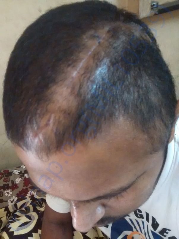 My brother photo