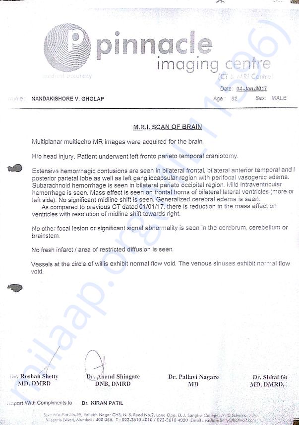 His report 1