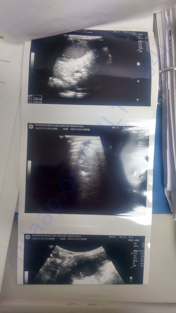 Ultra Sound Images