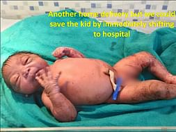 Save A Child from malnourishment