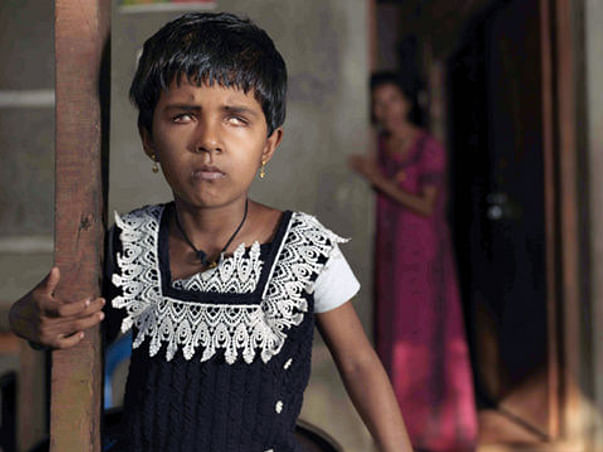 Help Endosulfan affected 32 children in Kasaragod