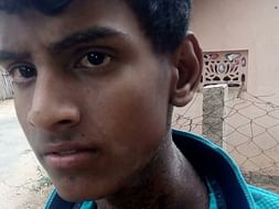 Help Ilavarasan Fight Nose Cancer