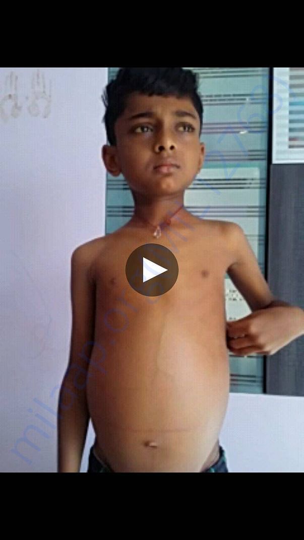 Mithilesh before surgery