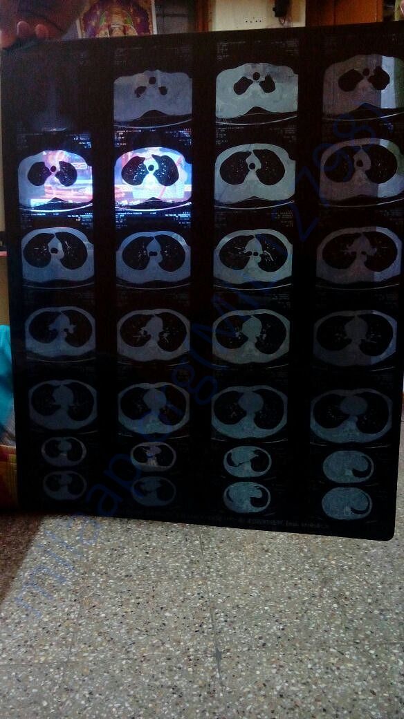1 MRI Scan Report