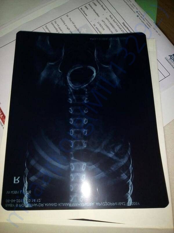 xray