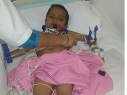 Help Durga Malleshwar Rao to fight Liver problem