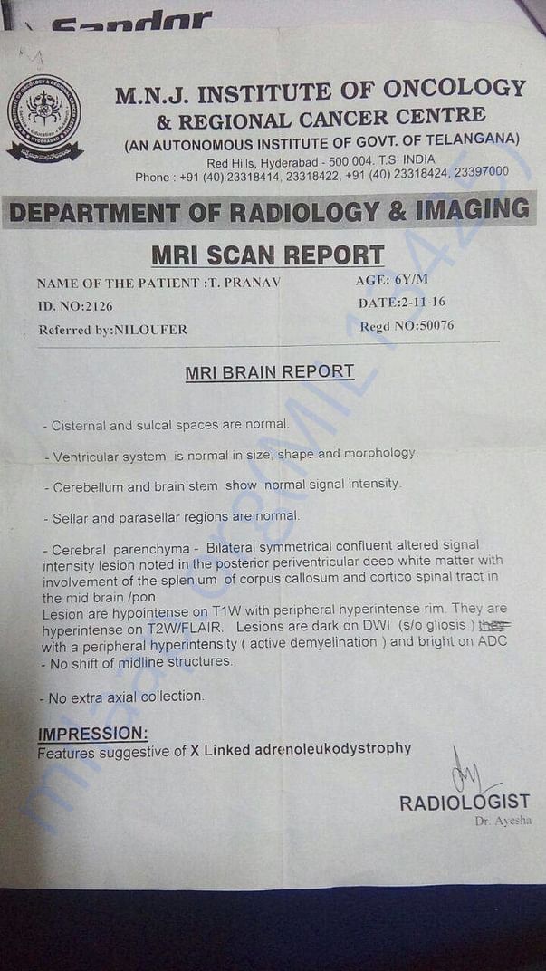 MRI Scan
