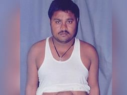 Vinod Was Declared Dead Before Being Operated Upon. Help This Fighter