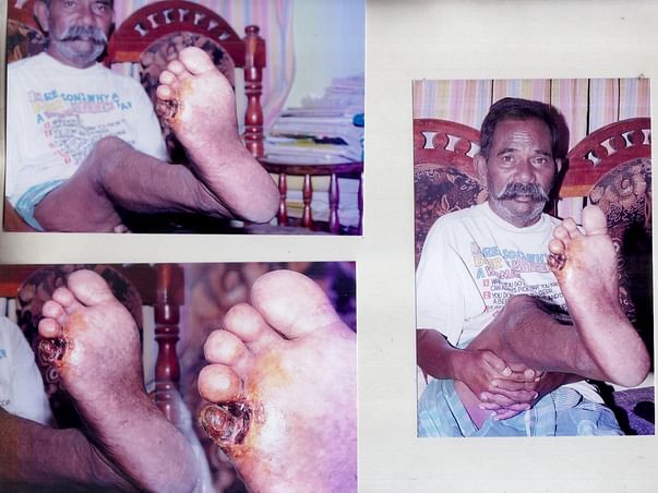 Help me to fight blocked veins ( Right leg to Heart )