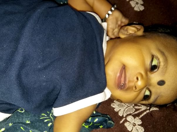 6-month-old Baby Nainitha Needs To Undergo Liver Transplant