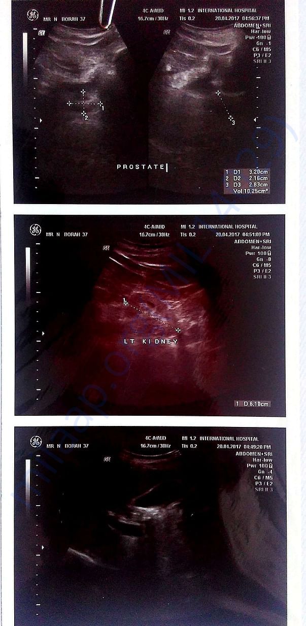 Ultrasound Report