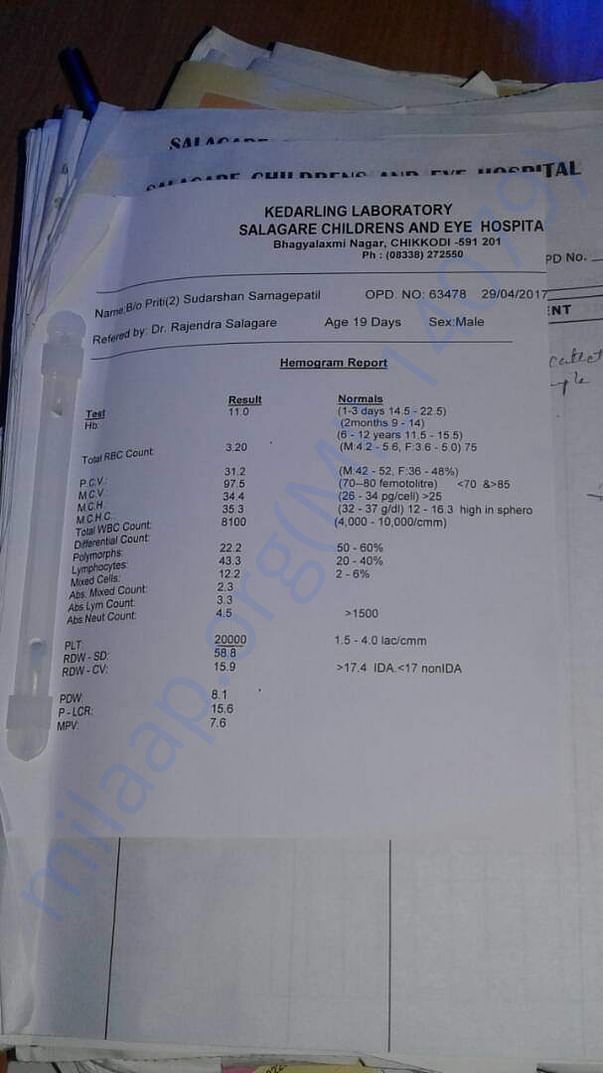 Blood report Showing severe thrombocytopenia (decreased platilets)