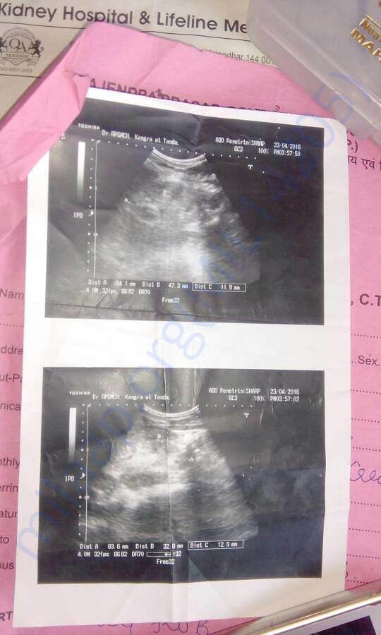 X-ray Of kidney