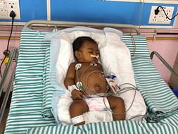 1 week Is All This Baby Has To Survive Acute Liver Failure