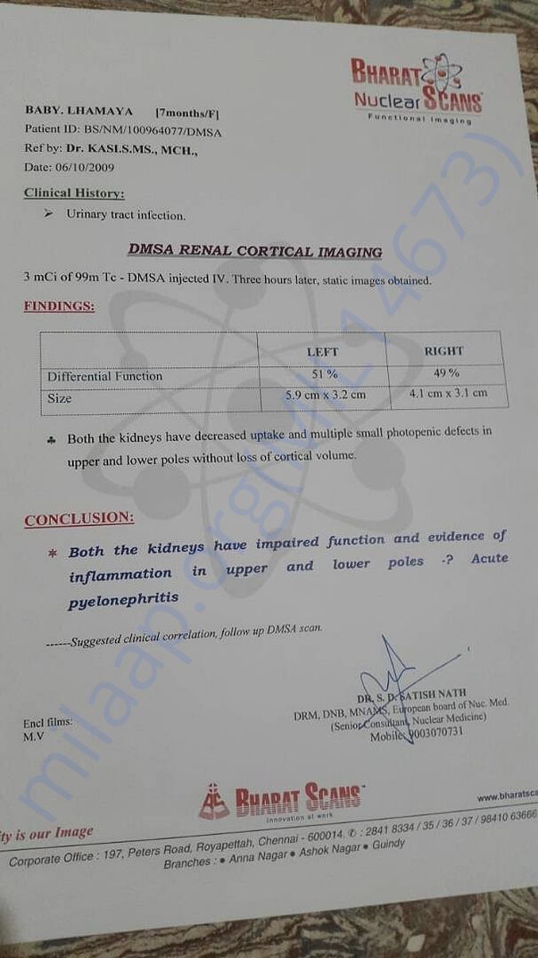 DMSA Renal cortical imaging