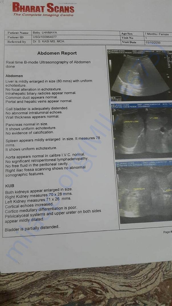 Abdomen report