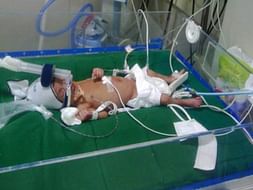 Baby Mehek-born at 32 weeks gestation pleads : "HELP ME FIGHT TO LIVE"