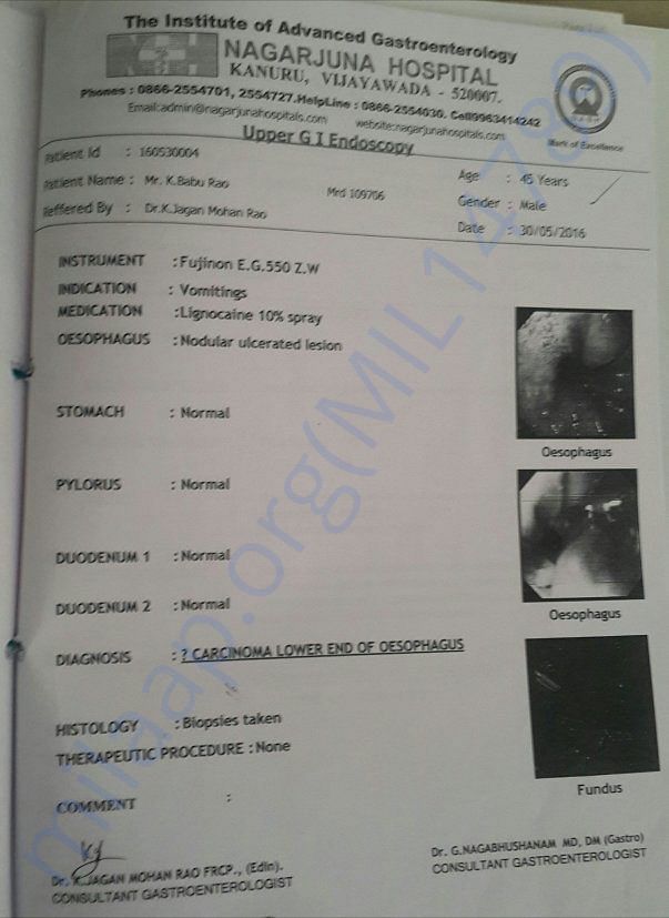 Biopsy