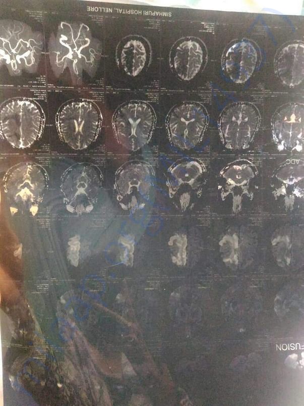 Head CT scan