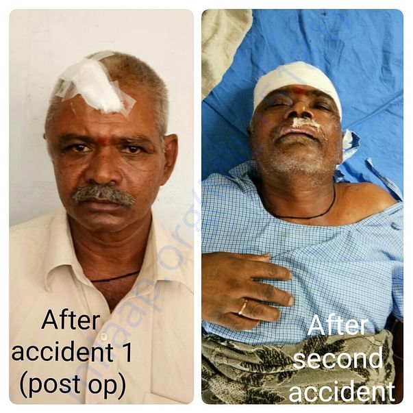 Picture after accident 1(after op) and after accident 2