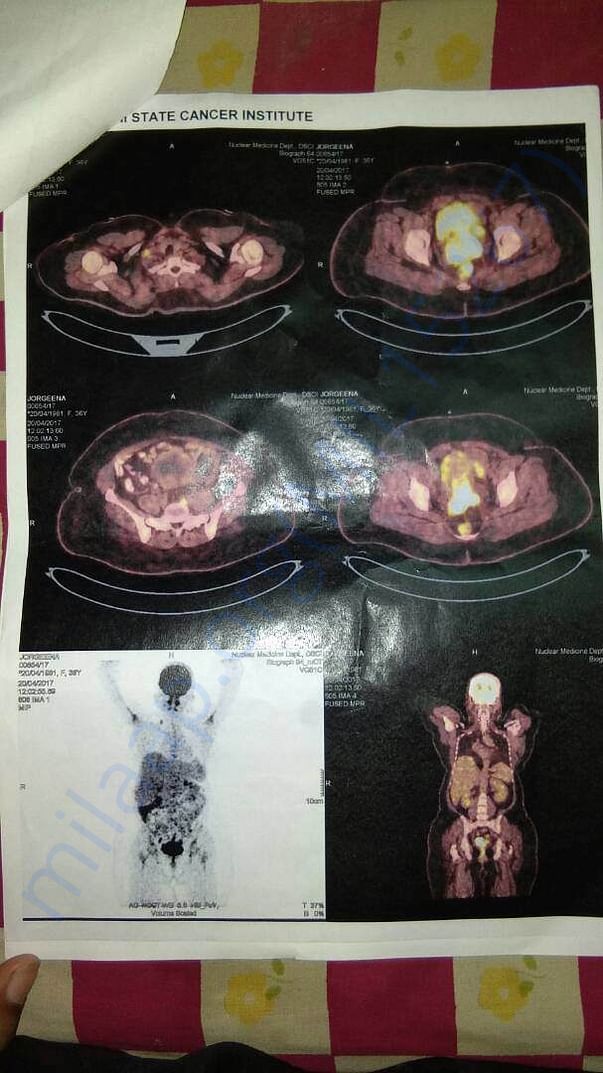 Cancer scan report