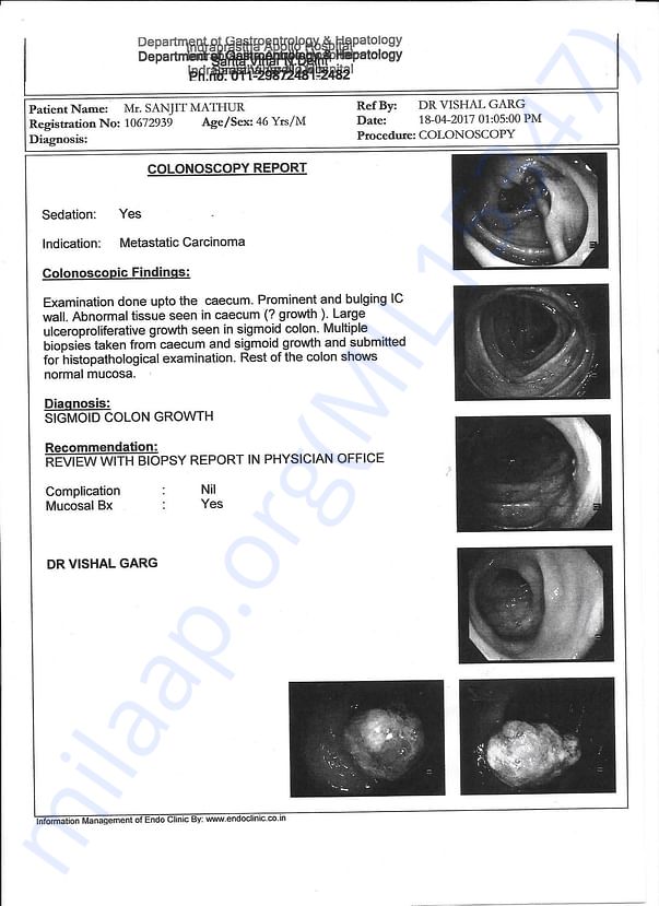 COLONOSCOPY REPORT (WITH TUMOR)