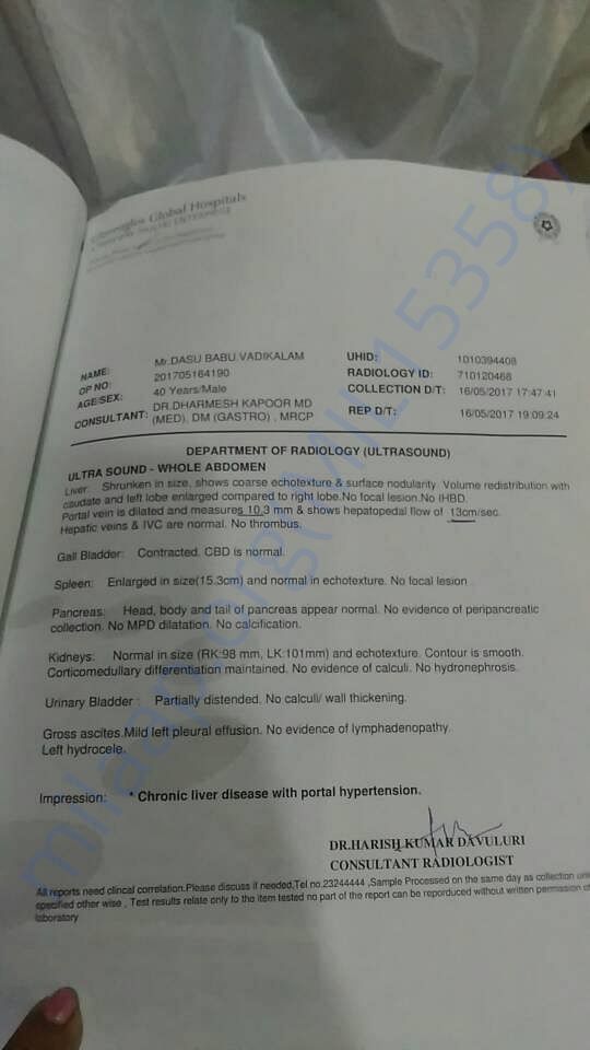 Diagnosis report of his liver taken at global hospitals in hyderabad