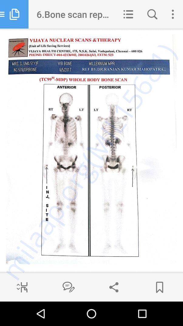 Bone test