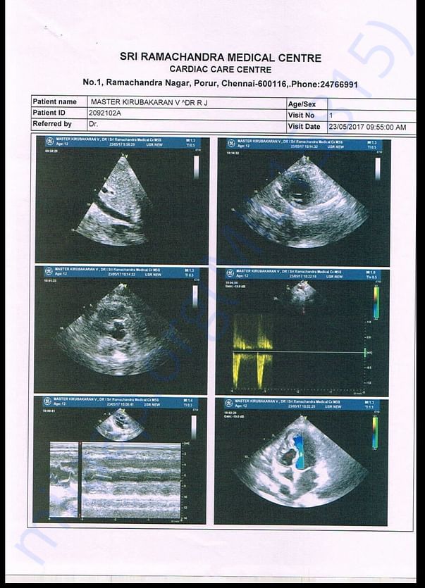 Heart scan report