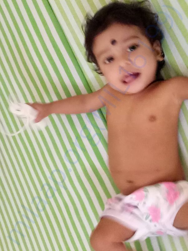 After Liver Transplantation