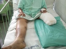 Help Vijaya Shenoy with Rehabilitation