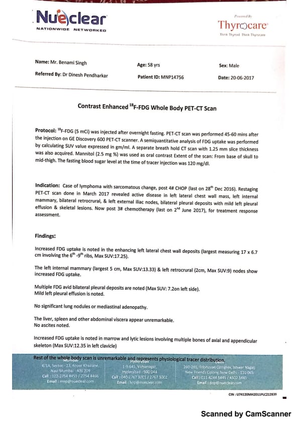 Help My Father Fight Against This Severe Form Of Cancer Milaap