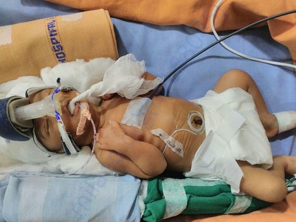 My baby photo in NICU