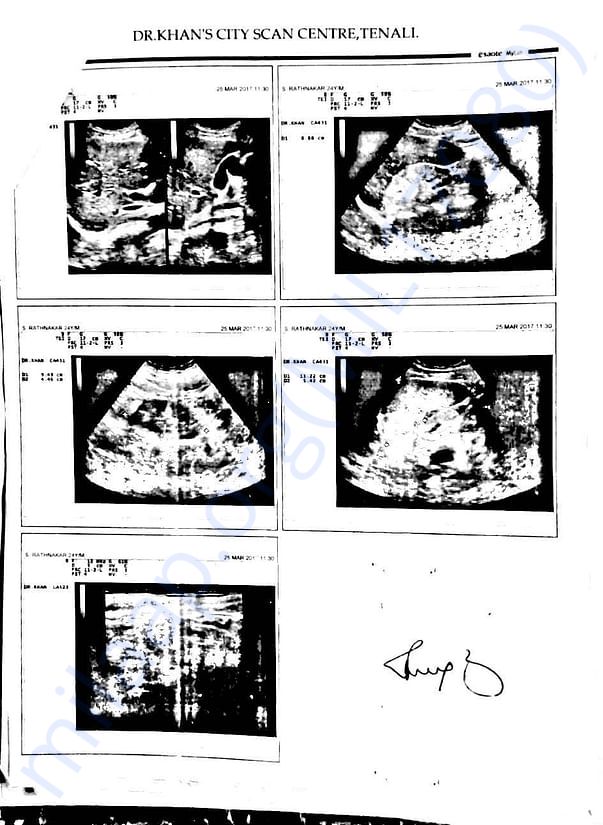 scans