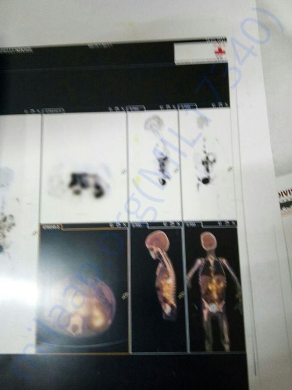 Scan Image
