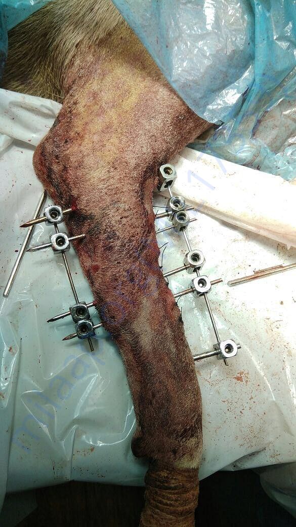 Pins attached after surgery