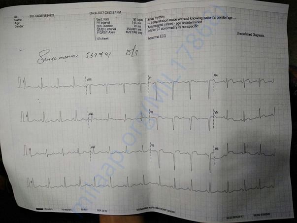 ECG report