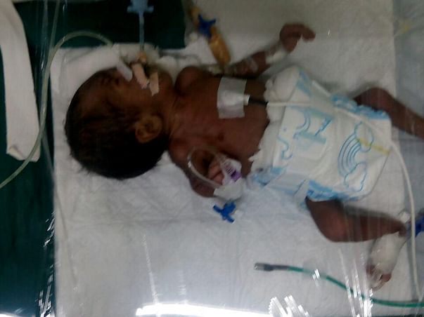 We Had A Baby After 20 Years, And Now He Too Might Slip Away