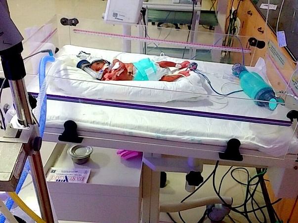 Help My Premature Baby For Survival