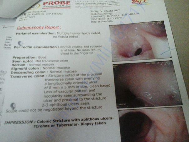 Colonoscopy reports