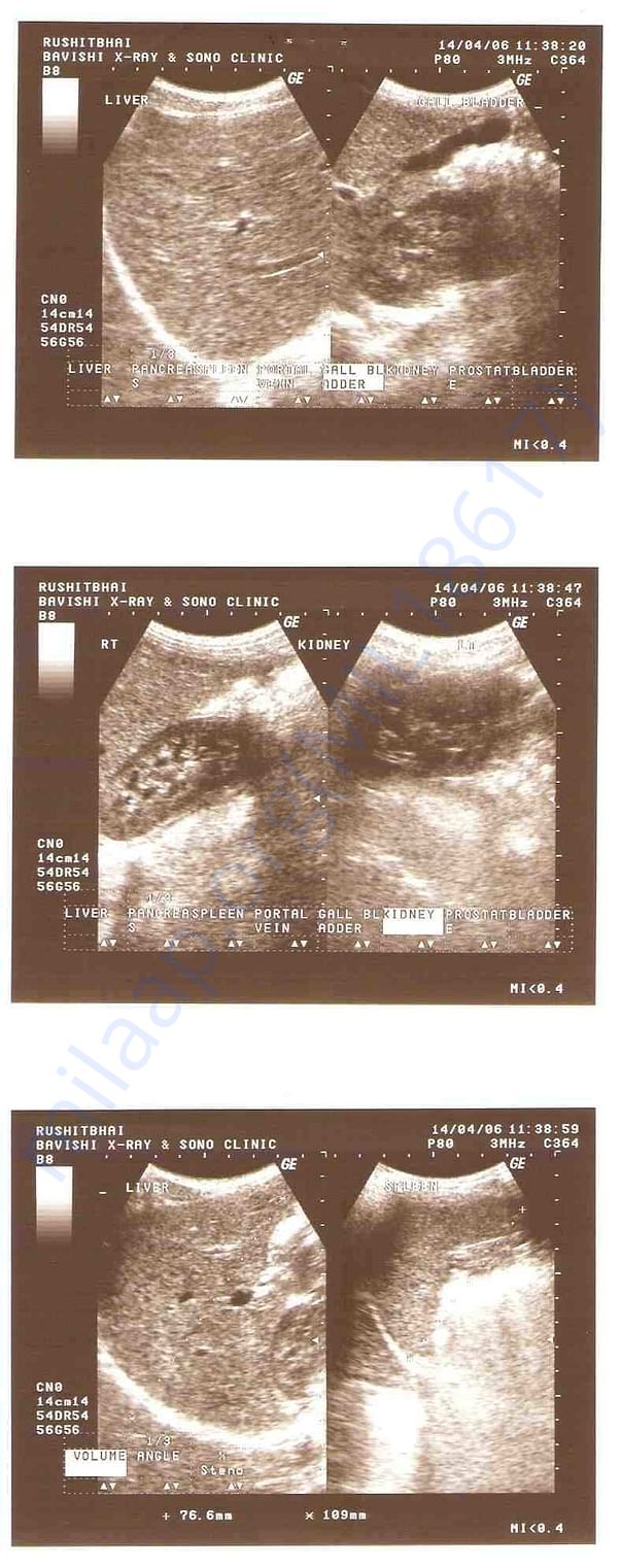 Chest Report