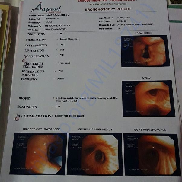Lung Biopsy