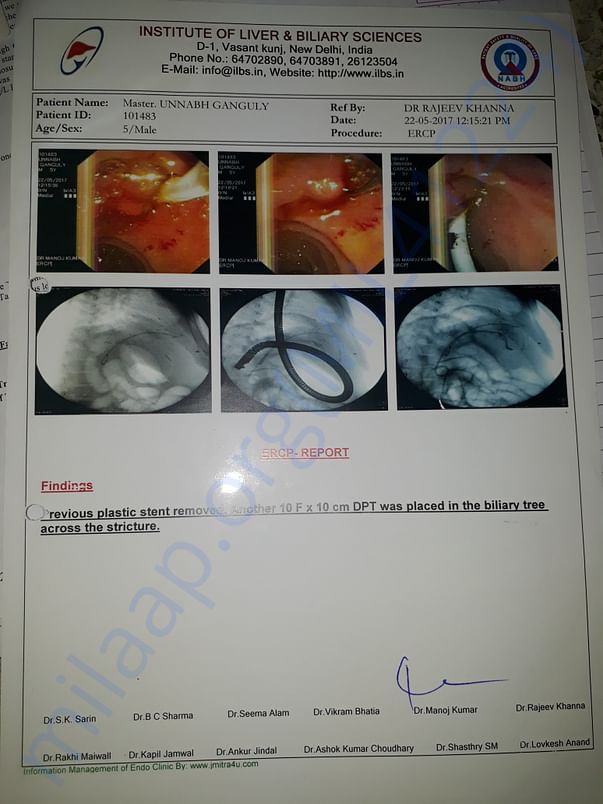 ERCP for stent replacement
