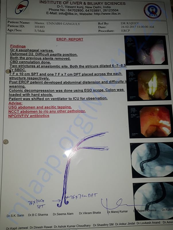 ERCP complications